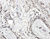 CAB39 Recombinant antibody