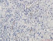 CD105 Recombinant antibody