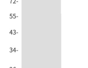 CD105 Recombinant antibody