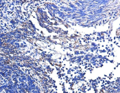 UQCRB Recombinant antibody