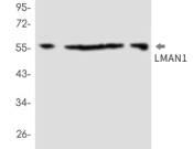 LMAN1 Recombinant antibody