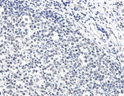 Ku70 Recombinant antibody