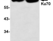 Ku70 Recombinant antibody