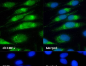 P4HB Recombinant antibody