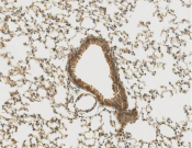 Desmin Recombinant antibody