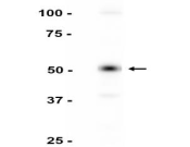Desmin Recombinant antibody