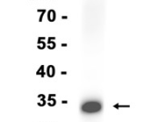 Syntaxin 1B Recombinant antibody