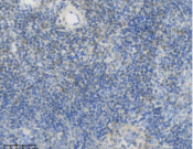 Bcl2 Recombinant antibody