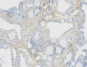 PDGFR beta Recombinant antibody