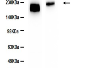 PDGFR beta Recombinant antibody