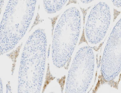 CCR8 Recombinant antibody