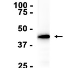 CCR8 Recombinant antibody