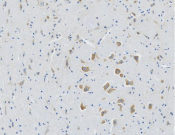 DLAT Recombinant antibody
