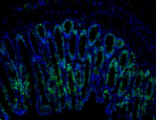 LGR5?Recombinant antibody