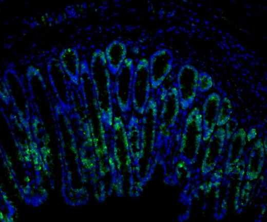 LGR5?Recombinant antibody