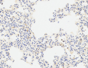 TNF-alpha Recombinant antibody
