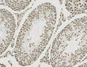 TAF15 Recombinant antibody