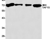 TAF15 Recombinant antibody