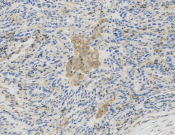 Talin-1 Recombinant antibody