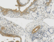 TSG101 Recombinant antibody