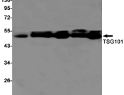 TSG101 Recombinant antibody