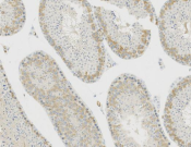 YTHDC2 Recombinant antibody