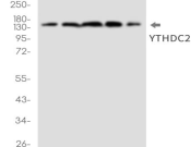 YTHDC2 Recombinant antibody