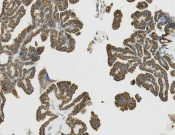 JAK3?Recombinant antibody