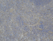 PARP1 Recombinant antibody