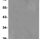 PARP1 Recombinant antibody