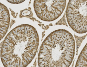 ERK1/2 Recombinant antibody