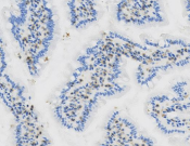 CD45 Recombinant antibody