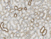 STAR Recombinant antibody