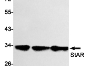 STAR Recombinant antibody