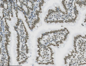 Acetyl-Histone H3 (Lys27) Recombinant antibody