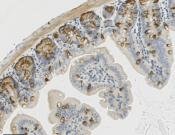 IkB Alpha Recombinant antibody