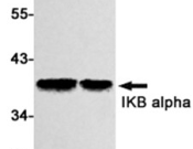 IkB Alpha Recombinant antibody