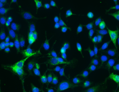 Osteopontin Recombinant antibody