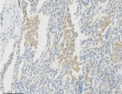 PD-L1 Recombinant antibody