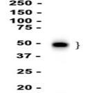 PD-L1 Recombinant antibody