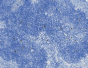 Phospho-Histone H2A.X (Ser139) Recombinant antibody