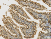 CDX2 Recombinant antibody