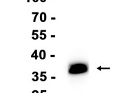CDX2 Recombinant antibody