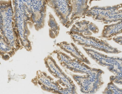E-cadherin Recombinant antibody