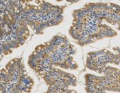 GSTK1 Recombinant antibody