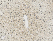 HDAC3 Recombinant antibody