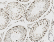 IRF3 Recombinant antibody