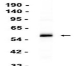 IRF3 Recombinant antibody