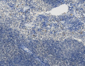 MYH9 Recombinant antibody