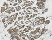 PDI Recombinant antibody